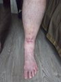 Geoff's leg